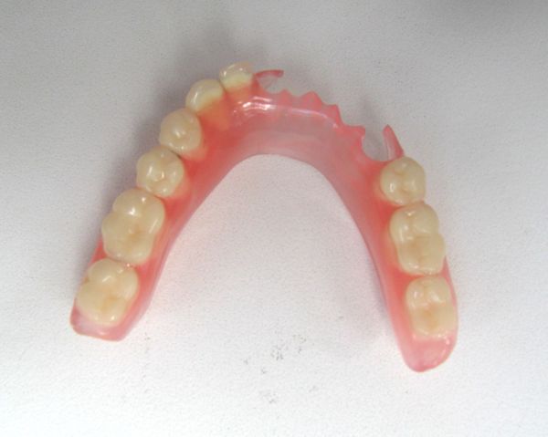 nejlonovye zubnye protezy 2